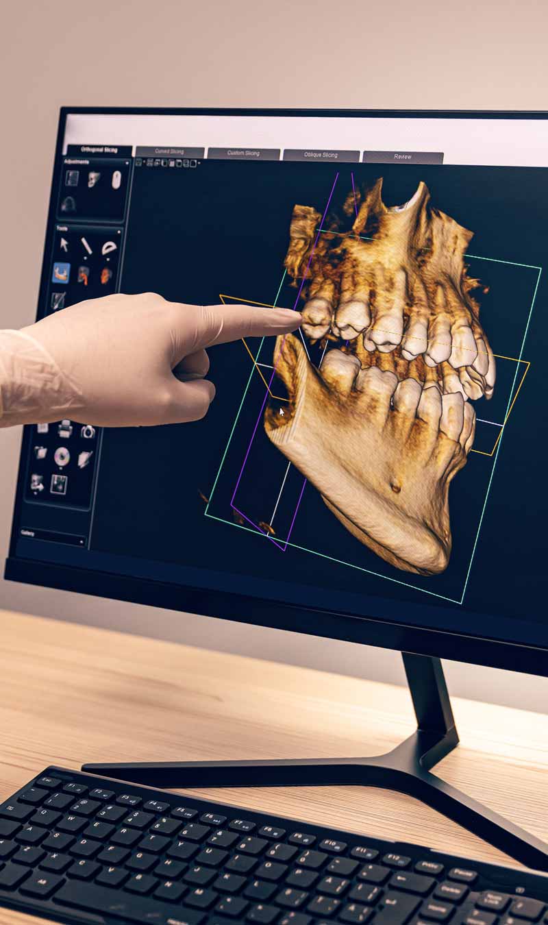 Las manos de un doctor dentista en guantes muestran los dientes de una persona en pantalla digital en clínica dental.
